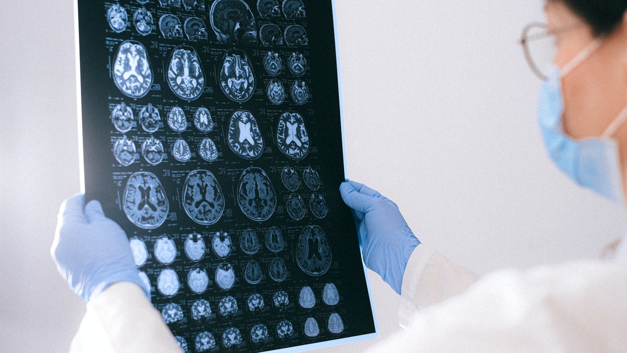 effects of psychotropic drugs on the brain
